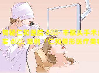 揭秘仁和医院 🌷 丰额头手术真实 🦅 案例「仁和整形医疗美容」